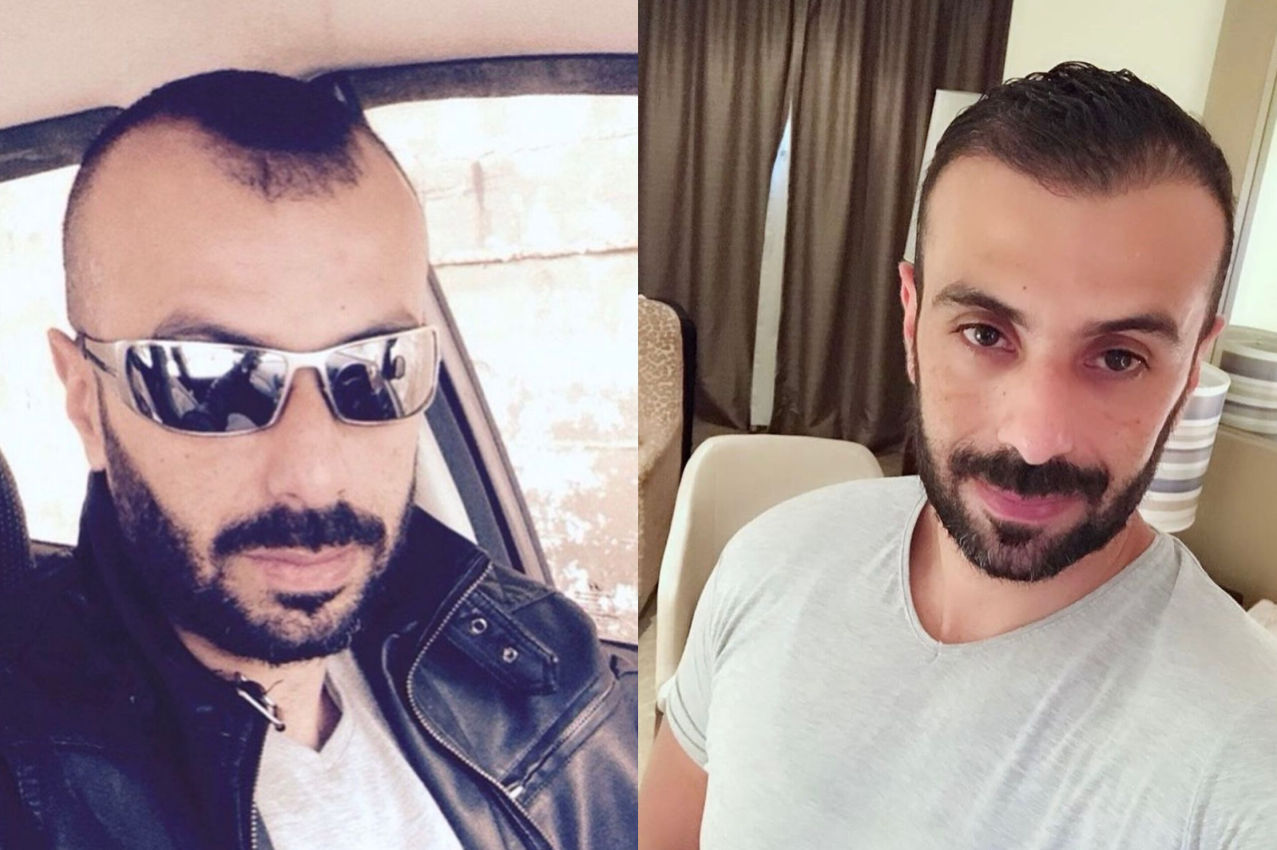 Antes y después.